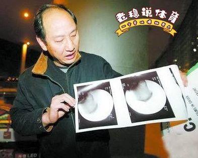 被骂10年后，刘翔突然上热搜，内容让人泪目……