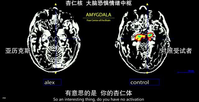 豆瓣9.0，每天都有人在网上问这部纪录片的男主角死了没