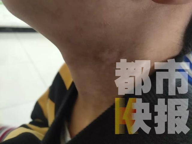 7岁男童遭亲妈家暴却仍想她：打就打呗 不然没妈妈了…令人红了眼眶