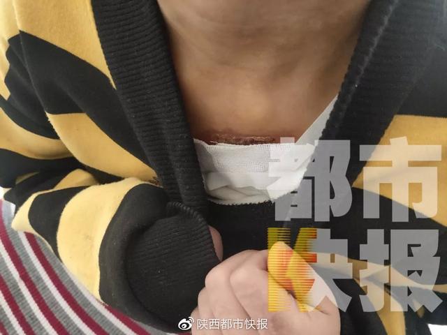 7岁男童遭亲妈家暴却仍想她：打就打呗 不然没妈妈了…令人红了眼眶