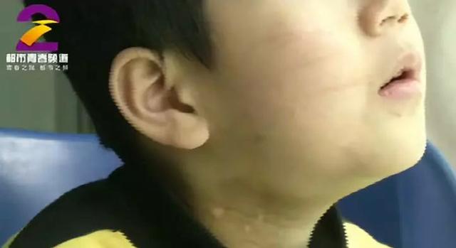 7岁男童遭亲妈家暴却仍想她：打就打呗 不然没妈妈了…令人红了眼眶
