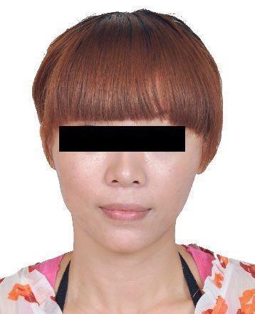 女子侵吞公司百万资金潜逃，整形成“别人”，16年后仍被抓