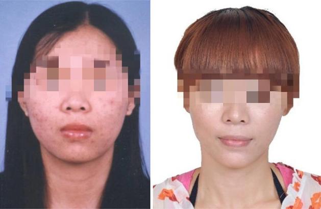 女子侵吞公司百万资金潜逃，整形成“别人”，16年后仍被抓